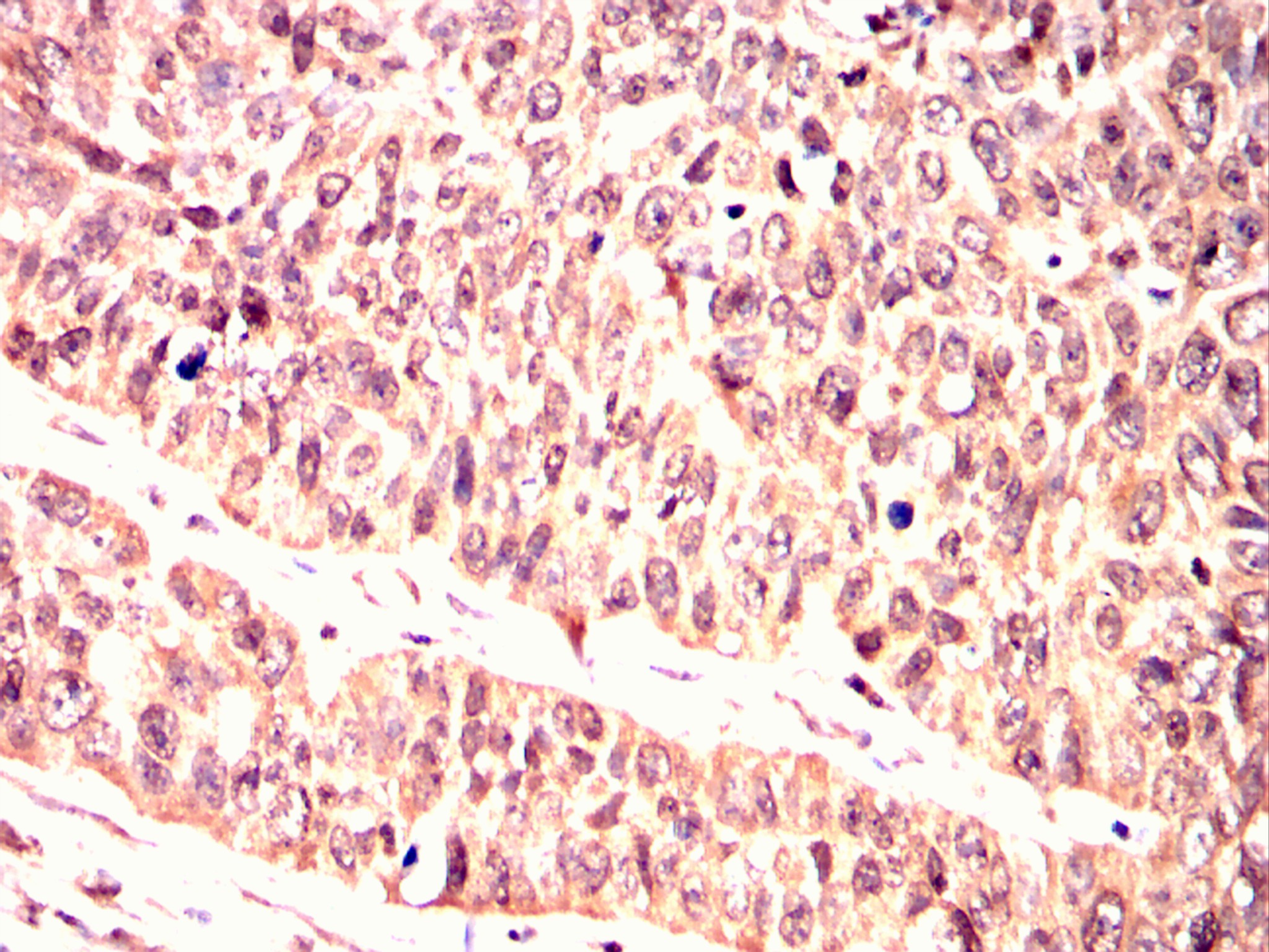 		IHC